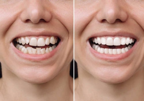 Navigating the Journey: Moving Experiences Before and After